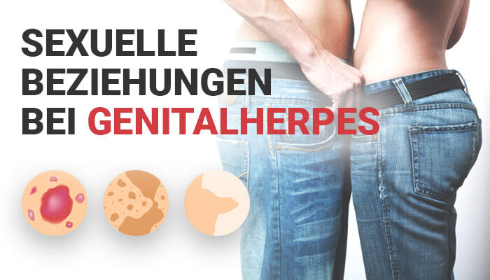 Genitalherpes ohne Sexuellen Kontakt